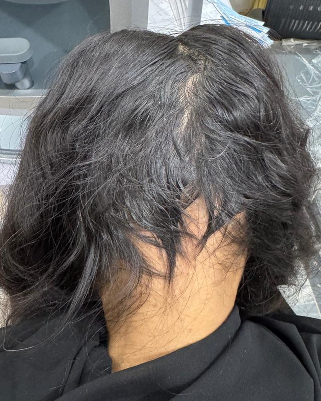 After treatment: the patient's scalp