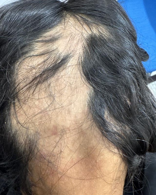 Before treatment: the patient's scalp