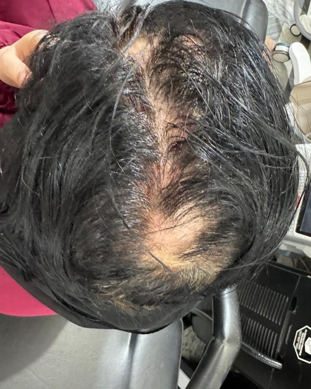 After treatment: the top of the patient's head