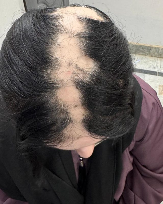 Before treatment: the top of the patient's head
