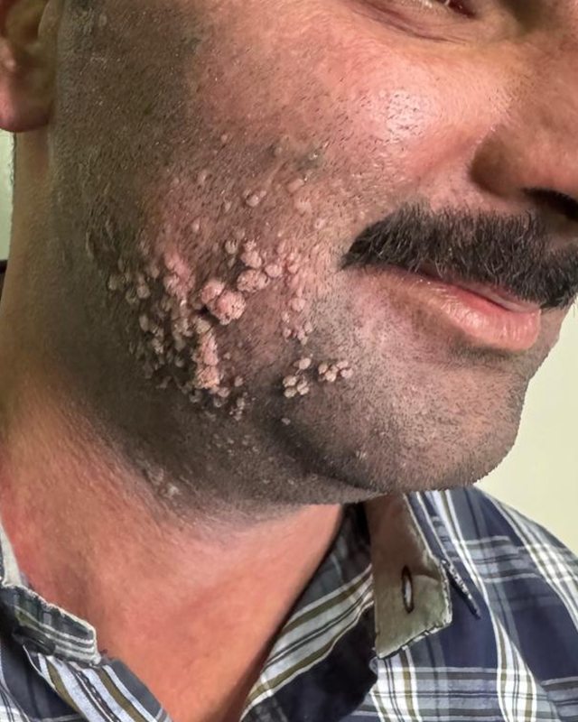 Before treatment: the patient's cheek and jaw